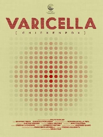 Varicella